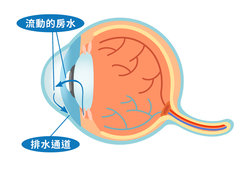 ecd_glaucoma_know